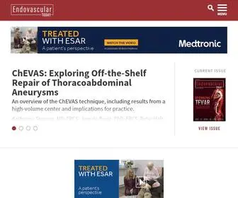 Evtoday.com(Endovascular Today) Screenshot