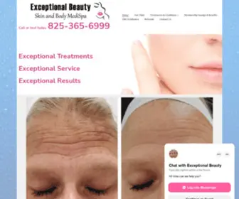 Exceptionalbeauty.ca(Exceptional Beauty) Screenshot