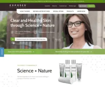 Exposedskincare.com(Exposed Skin Care) Screenshot