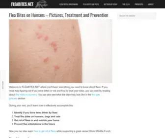 Fleabites.net(Pictures, Treatment and Prevention) Screenshot