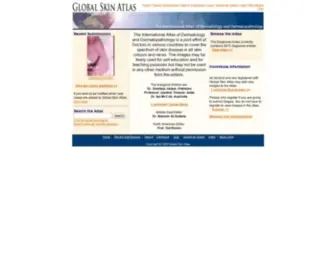 Globalskinatlas.com(Global Skin Atlas) Screenshot