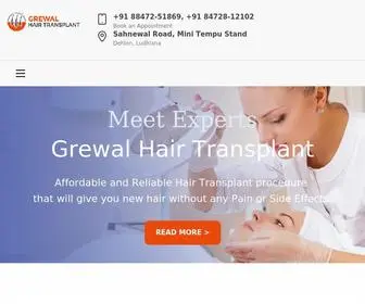 Grewalhairtransplant.com(Grewal Hair Transplant Centre) Screenshot