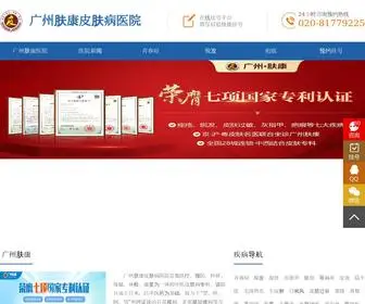 GZPFYY120.com(广州肤康皮肤医院) Screenshot