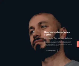 Haartransplantationtuerkei.com(Haartransplantation Türkei) Screenshot