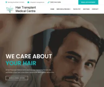Hair-Transplant.ca(Hair Transplant Medical Center) Screenshot