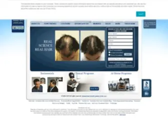 Hairgrowthcenters.com(Hair Loss Treatment) Screenshot