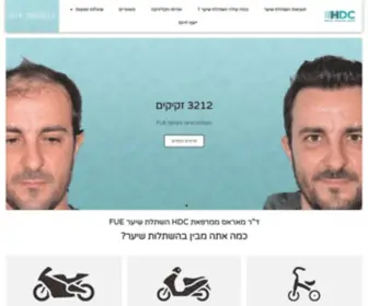 Hairtransplant-CY.co.il(השתלת שיער בחו"ל בשיטת FUE ע"י ד"ר מאראס) Screenshot