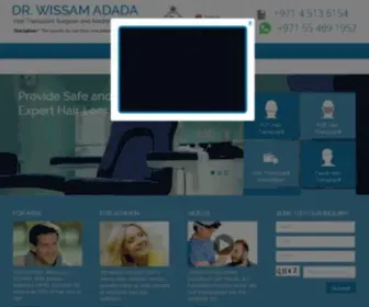 Hairtransplant.ae(Hair Transplant Clinic Dubai) Screenshot