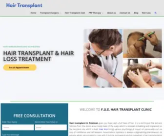 Hairtransplantinpakistan.com(Hair transplant in Pakistan) Screenshot