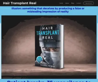 Hairtransplantreal.com(Hair Transplant Real) Screenshot