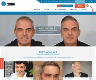 Hairtransplantsurgery.ie(Hair Transplant Clinic Ireland) Screenshot