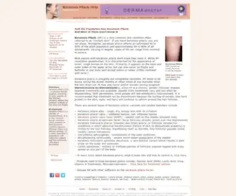 Helpforkp.com(Keratosis Pilaris) Screenshot