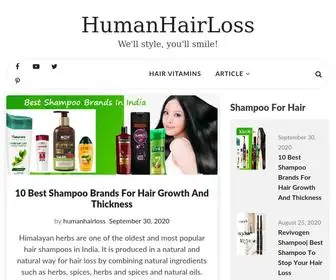 Humanhairloss.online(We'll style) Screenshot