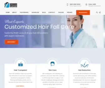 IgraftGlobalhairservices.com(Hair Transplant) Screenshot