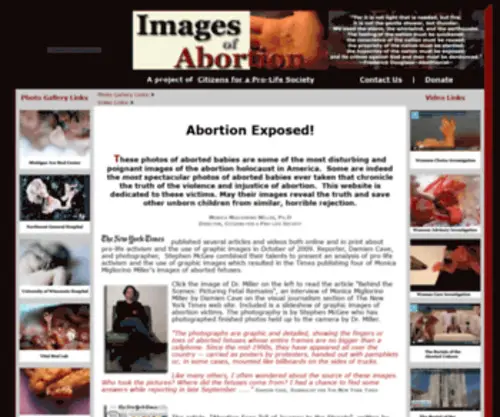 Imagesofabortion.com(Images of Abortion) Screenshot