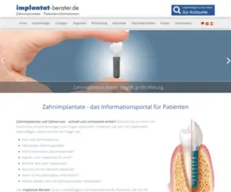 Implantat-Berater.de(Zahnimplantate) Screenshot