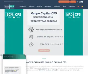 Implantes-Capilares.com(Especialistas en prevención y corrección de la calvicie (implantes capilares) Screenshot