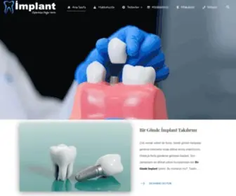 Implantt.com(Implant diş) Screenshot