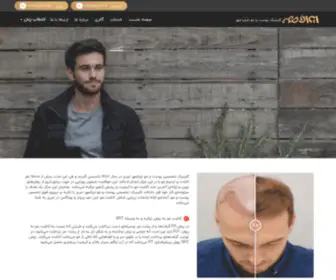 Iran-Mehr.com(کاشت مو در تبریز) Screenshot