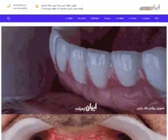 Iranimplantcenter.com(ایمپلنت) Screenshot