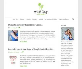 Itchylittleworld.com(Natural remedies for eczema to soothe your itchy little world) Screenshot