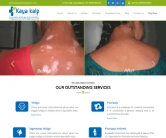 Kayakalpglobal.com(Kayakalp Global is one of the best Skin Care Clinic(ayurvedic)) Screenshot