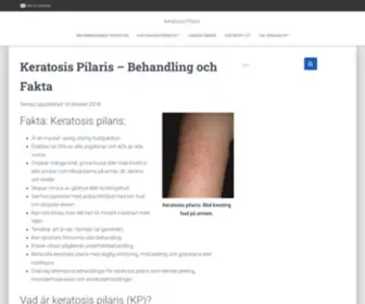 Keratosispilaris.se(Keratosis Pilaris) Screenshot