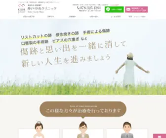 Kobe-Chuoh-Kizuato.com(リストカット跡) Screenshot