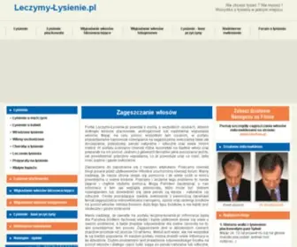 Leczymy-Lysienie.pl(Łysienie plackowate) Screenshot