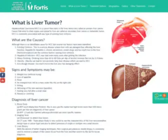 Livercancertreatment.in(Liver Tumor Dr) Screenshot