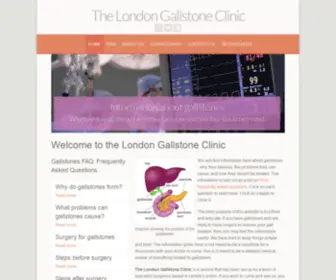 Londongallstoneclinic.com(Gallstone surgery) Screenshot