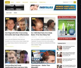 Malehairrecovery.com(How To Regrow Your Hair) Screenshot