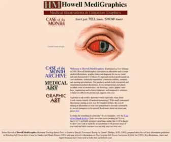 Medigraphics.com(Medical Legal Illustrations) Screenshot