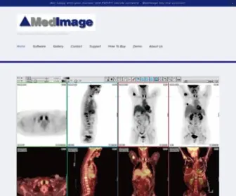 Medimage.com(Nuclear Medicine) Screenshot