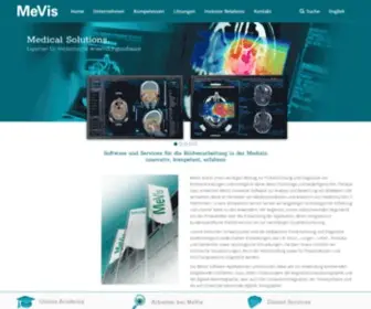 Mevis.de(MeVis Medical Solutions AG) Screenshot