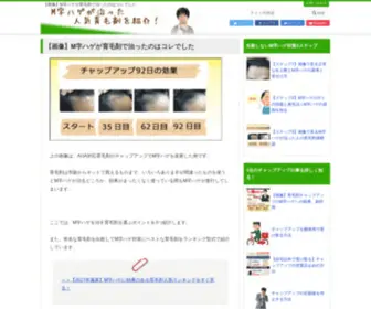 Mikuni-Clinic.jp(育毛剤を使って実際にM字ハゲが治った育毛剤) Screenshot