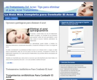 Mitratamientodelacne.com(Mi Tratamiento Del Acne) Screenshot