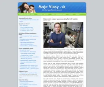 Mojevlasy.sk(Vypadávanie vlasov) Screenshot