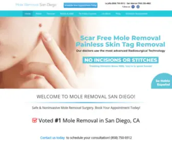 Moleremovalsandiego.com(Affordable Mole Removal San Diego) Screenshot