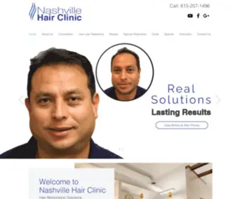 Nashvillehairclinic.com(Nashville Hair Clinic) Screenshot