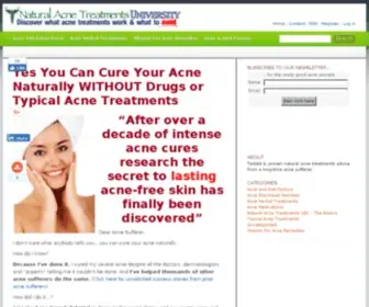 Natural-Acne-Treatments.com(Proven Natural Acne Treatments) Screenshot