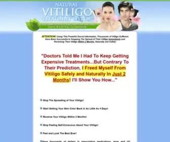 Naturalvitiligotreatmentsystem.net(The Secret Home Vitiligo Cure) Screenshot