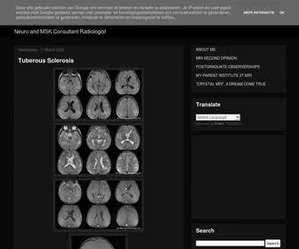 Neuroradiologycases.com(Dr Balaji Anvekar FRCR) Screenshot
