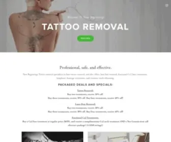 Newbeginningstattooremoval.com(Denver’s New Beginnings Tattoo Removal) Screenshot