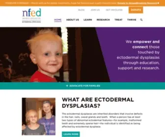 Nfed.org(National Foundation for Ectodermal Dysplasias) Screenshot