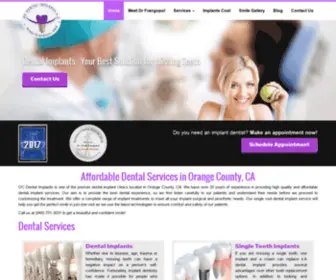 OCDentalimplants4U.com(California leading dentistry OC Dental implants) Screenshot