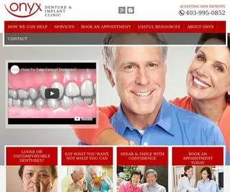 OnyxDenture.com(Onyx Denture and Implant Clinic) Screenshot