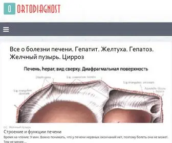 Ortodiagnost.ru(Все о болезни печени) Screenshot