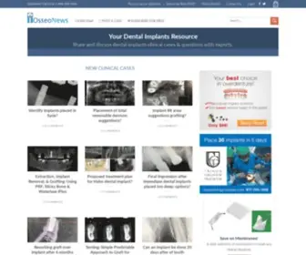 Osseonews.com(Dental Implants) Screenshot