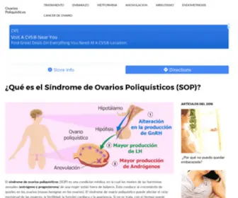 Ovarios-Poliquisticos.com(Todo sobre su Tratamiento) Screenshot